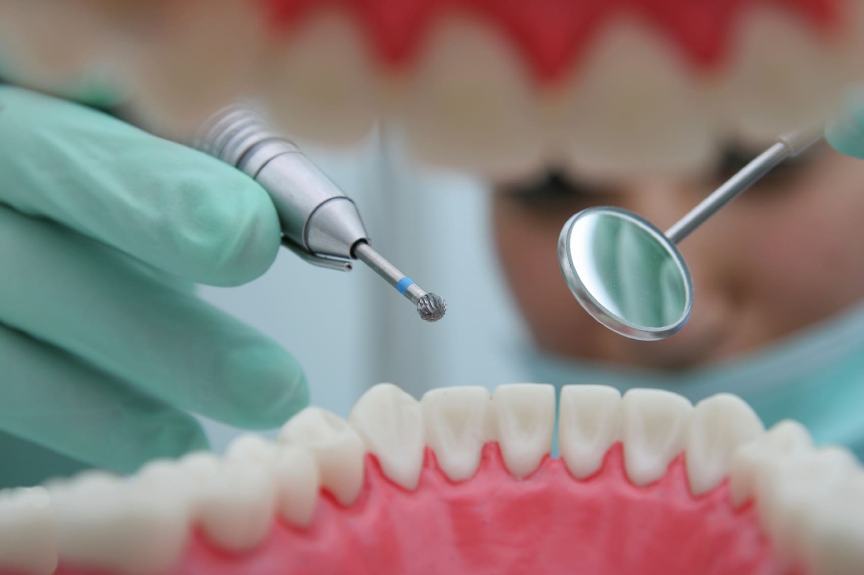 No Drill Dentistry Stops Tooth Decay New Research The University