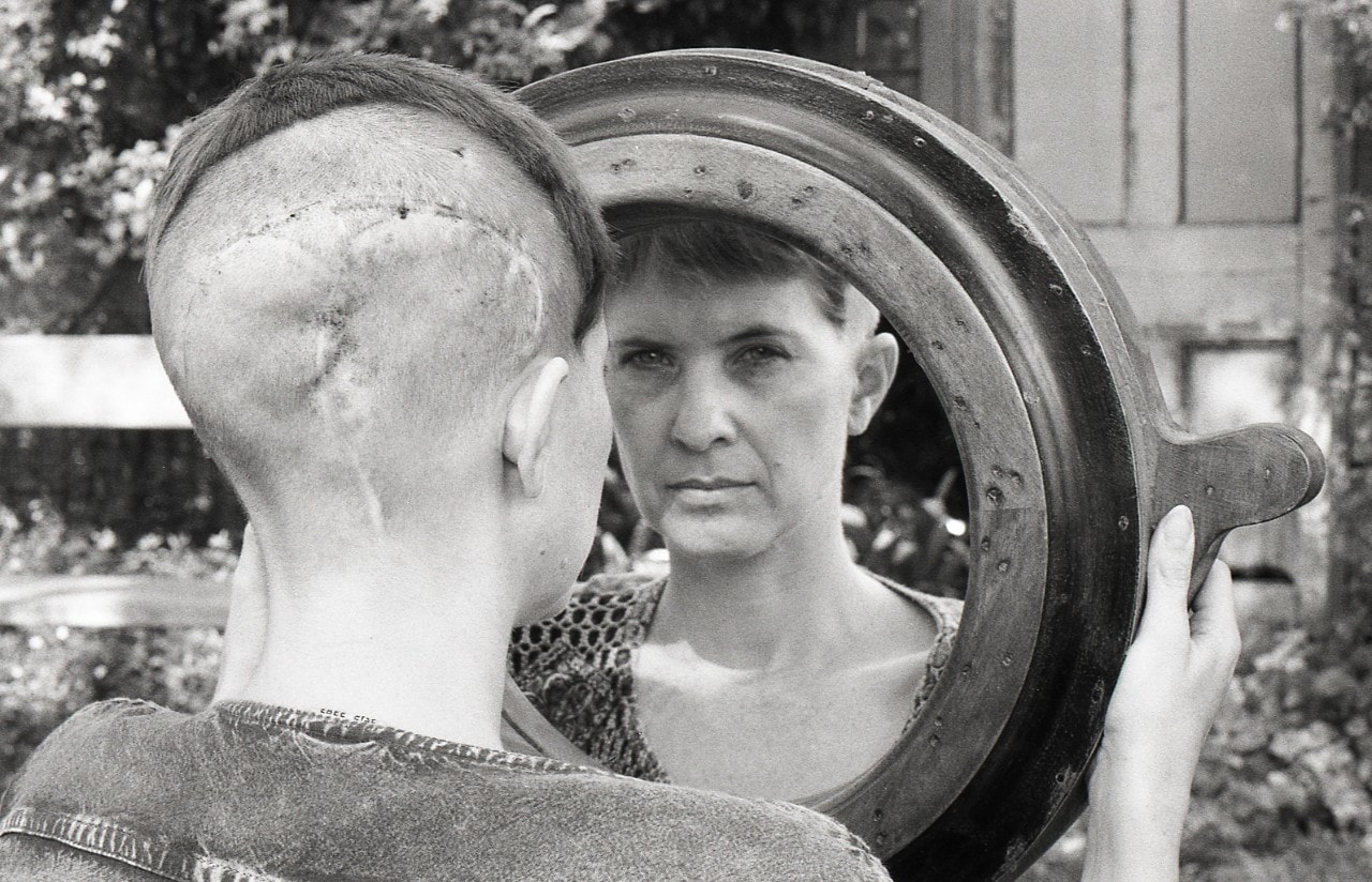 Anne Howell shot from behind looking into a mirror so her reflection is staring back. Her head is shaved in places following her surgery. 