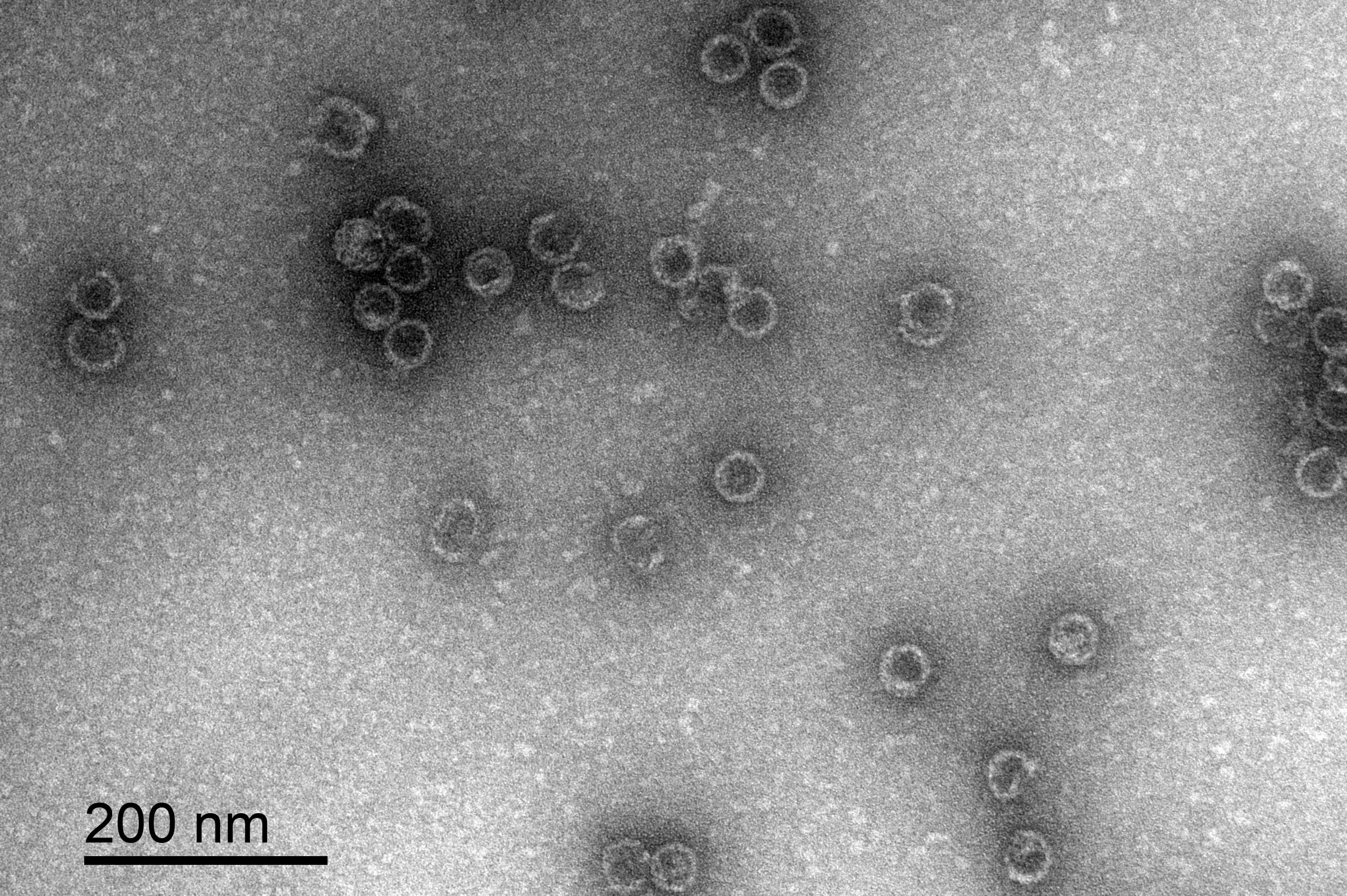 A transmission electron microscope image showing encapsulin compartments. Alex Loustau/USYD