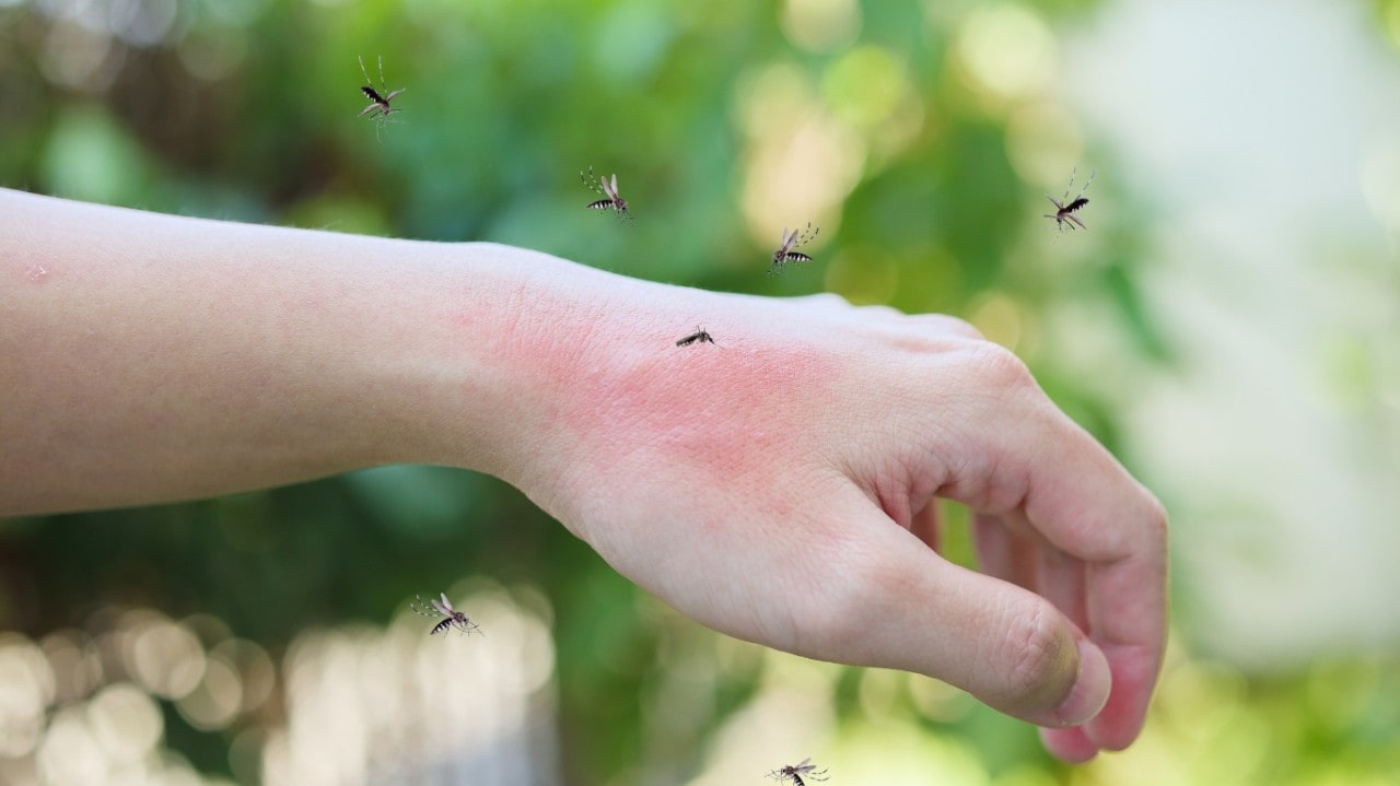 Hand with red mosquito bites surrounded by mosquitoes